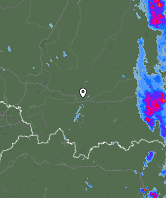 Radar