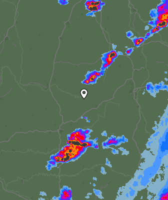 Radar