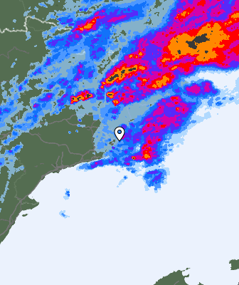 Radar