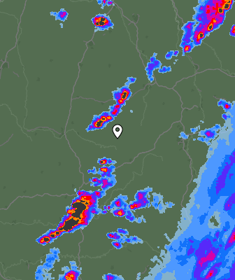 Radar