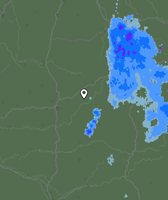Radar