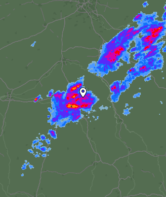 Radar