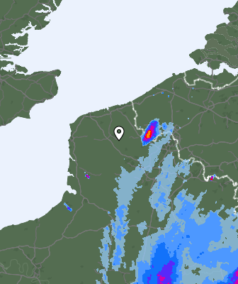 Radar
