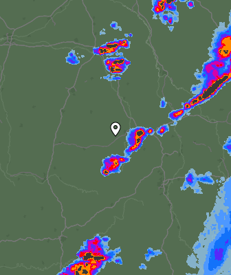 Radar