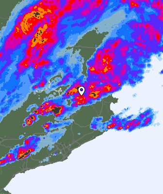 Radar