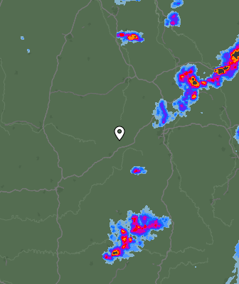 Radar
