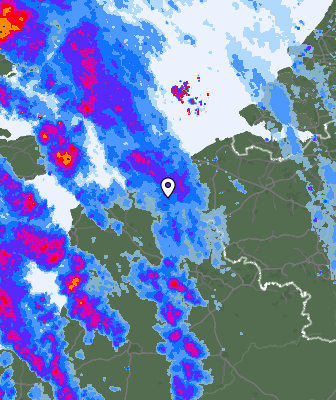 Radar