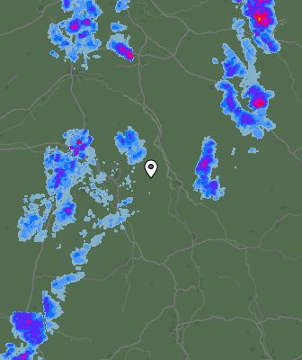 Radar