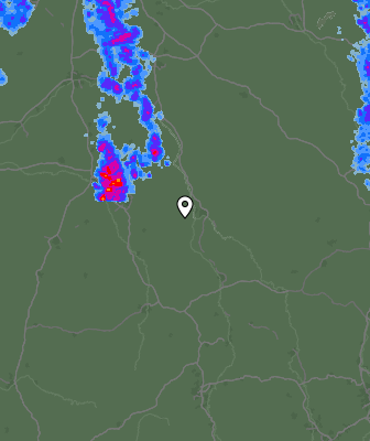 Radar