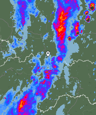Radar