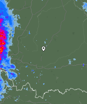 Radar