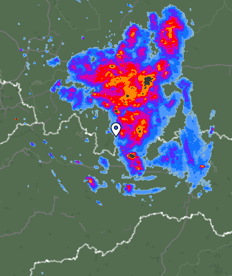 Radar