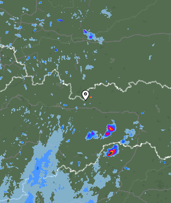 Radar