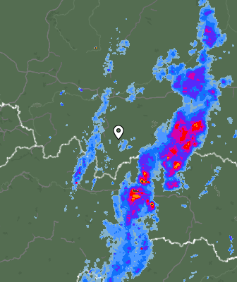 Radar