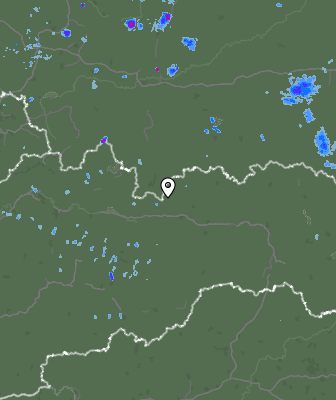 Radar