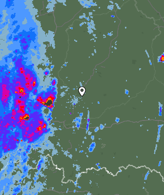 Radar