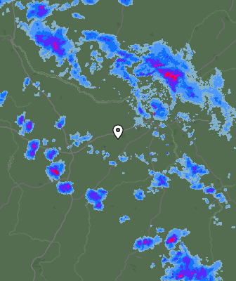 Radar