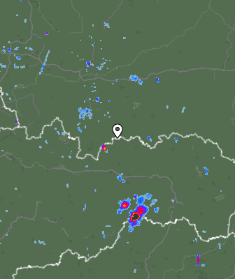 Radar