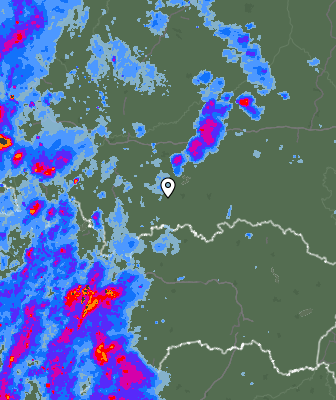 Radar