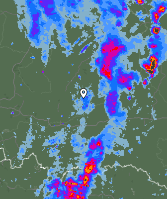 Radar