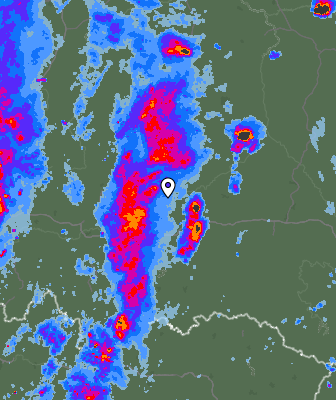 Radar