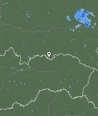 Radar