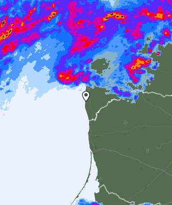 Radar