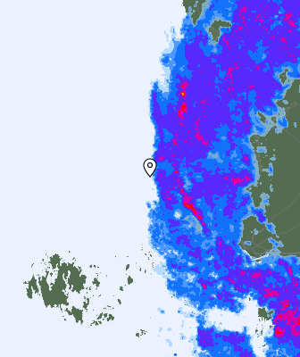 Radar