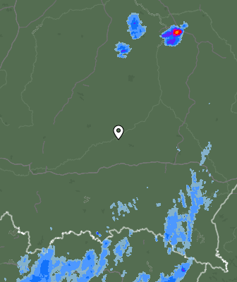 Radar