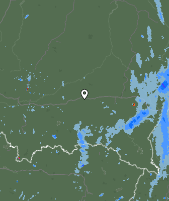 Radar