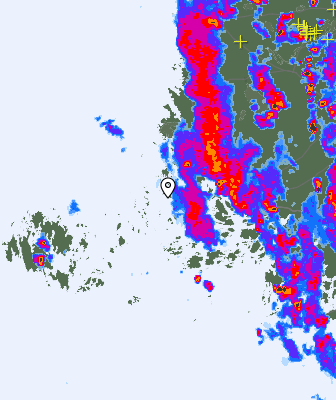 Radar
