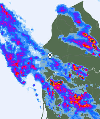 Radar