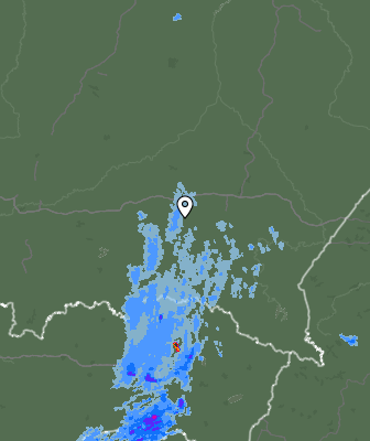 Radar
