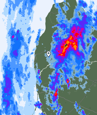 Radar