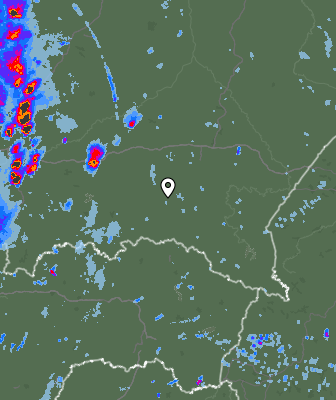 Radar