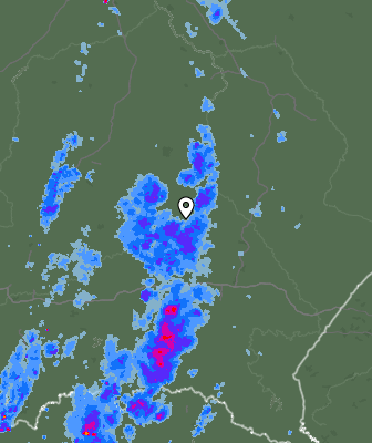 Radar