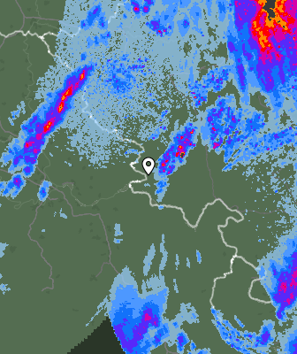 Radar