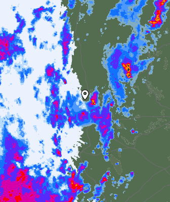Radar