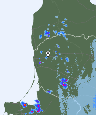 Radar