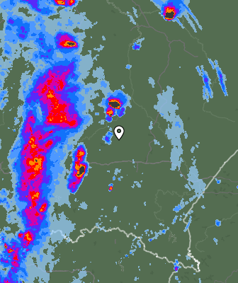 Radar