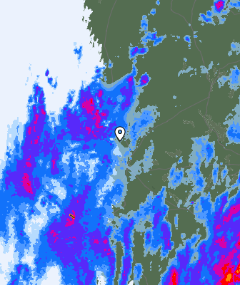 Radar