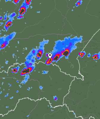 Radar