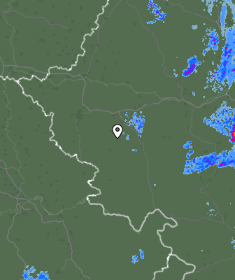 Radar