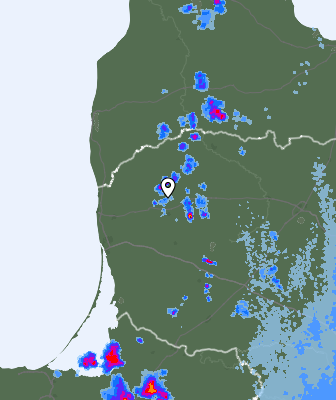 Radar