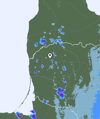 Radar