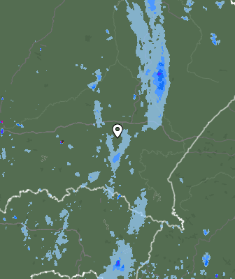 Radar
