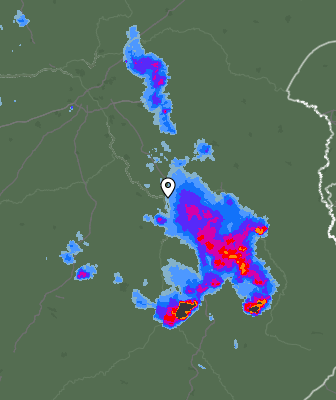 Radar