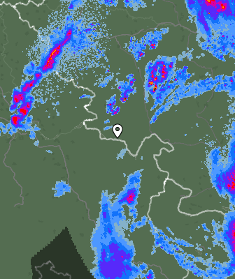 Radar