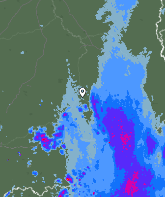 Radar