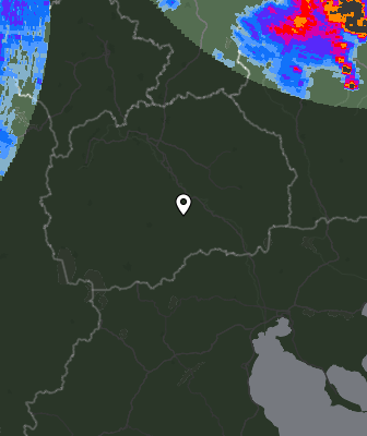 Radar